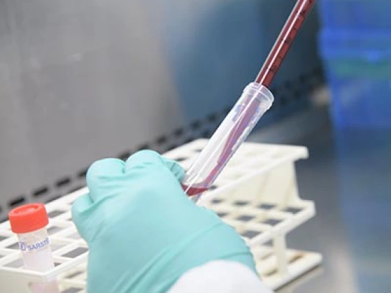 UArizona Health Sciences Study Shows SARS-CoV-2 Antibodies Provide Lasting Immunity